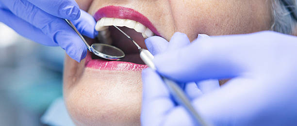 Best Chipped Tooth Repair Near Me  in Kennewick, WA