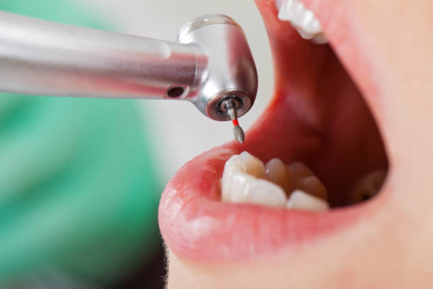 Emergency Dentist for Kids in WA